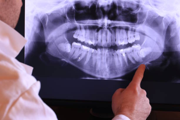 Teeth Whitening in OK