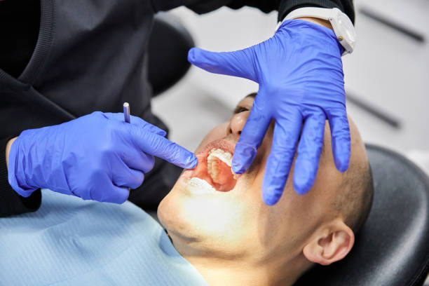 Best Teeth Whitening  in Mcloud, OK