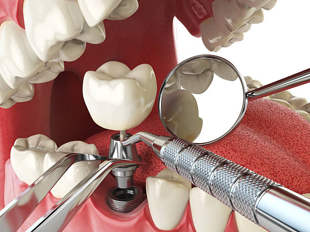 Best Emergency Gum Pain Relief  in Mcloud, OK